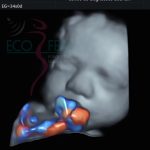 Imágenes de ultrasonido